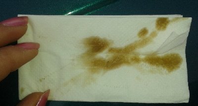 20150119_102835.jpg